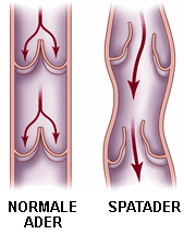 Spataders